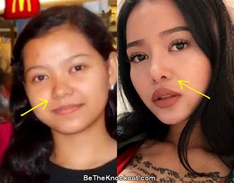 bella poarch before surgery|Bella Poarch: Plastic Surgery Before and After and。